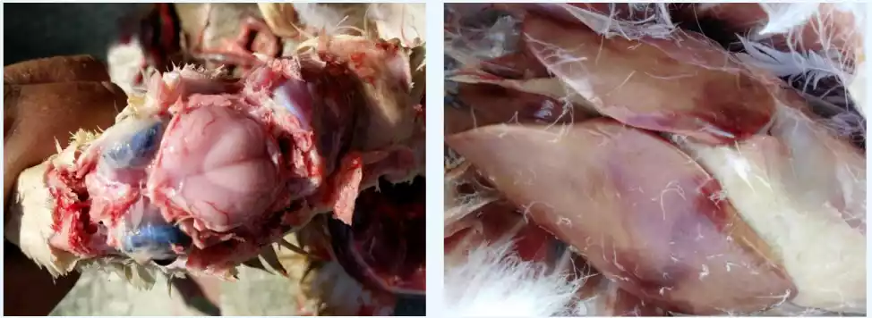 enlarged liver with hemorrhage