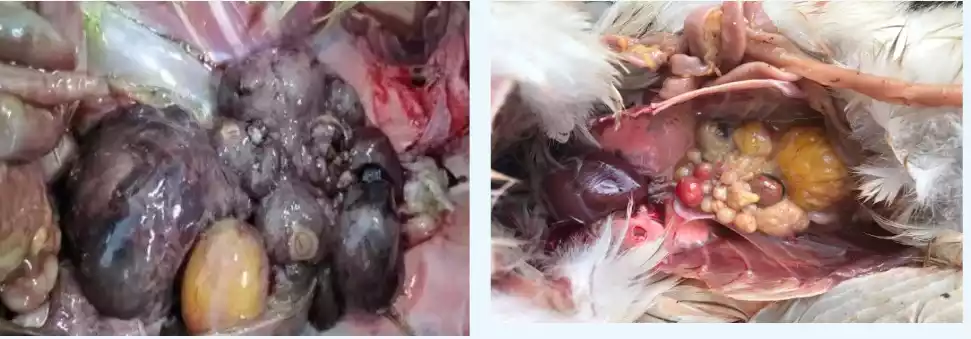 follicular hemorrhage and liquefaction